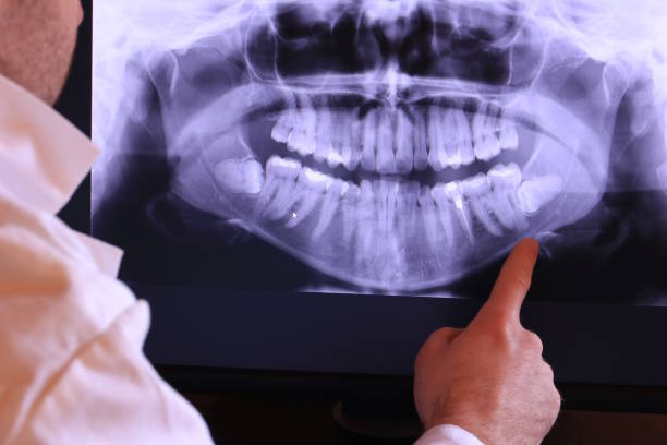 Best Emergency Tooth Extraction in Dunnavant, AL